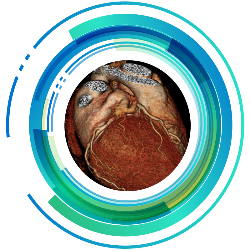 Die Cardio CT (Herz Computertomographie)